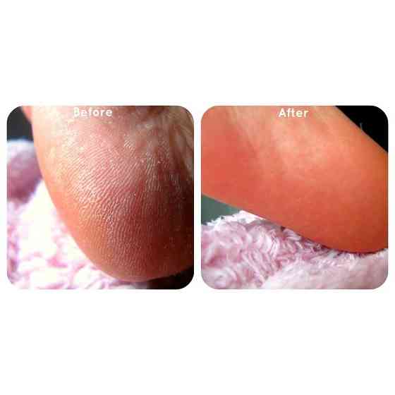 Набор для педикюра «Идеальные ножки» Ped Egg новый 