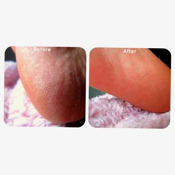 Набор для педикюра «Идеальные ножки» Ped Egg новый 