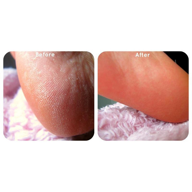 Набор для педикюра «Идеальные ножки» Ped Egg новый  - изображение 3