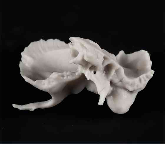 Кости черепа (височная и клиновидная) 