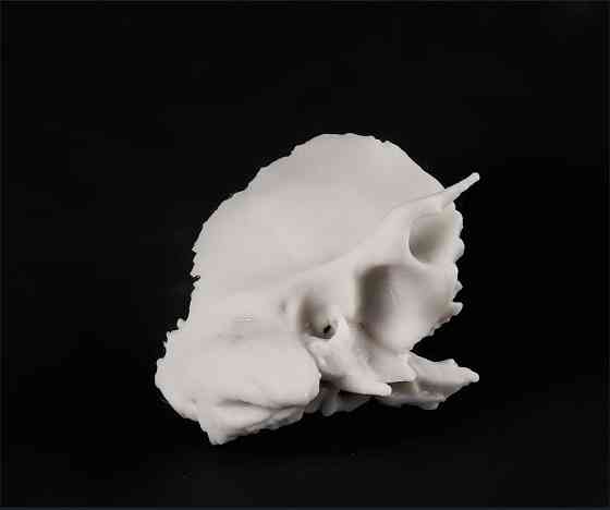 Кости черепа (височная и клиновидная) 