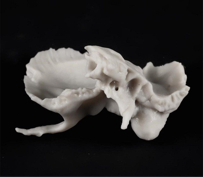 Кости черепа (височная и клиновидная)  - изображение 2