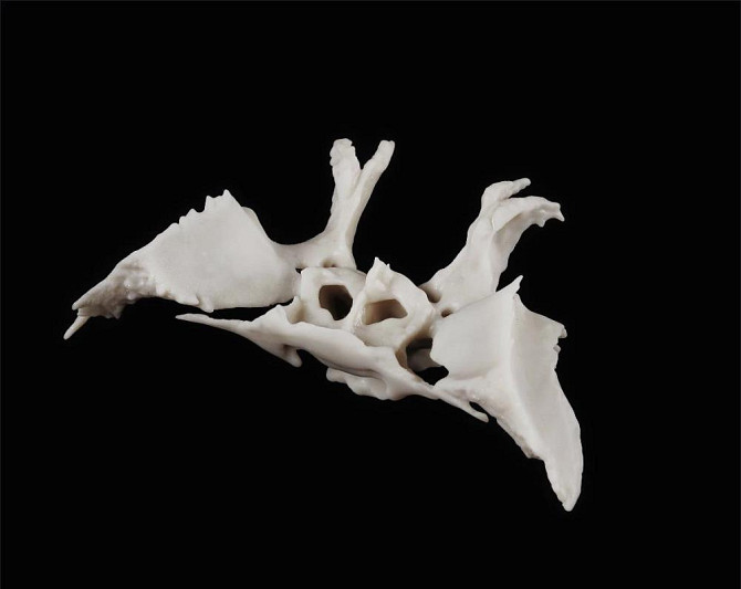 Кости черепа (височная и клиновидная)  - изображение 4